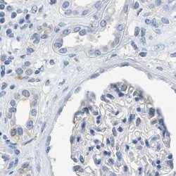 Invitrogen SERPINB1 Polyclonal Antibody 100 &mu;L; Unconjugated:Antibodies,