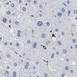 Invitrogen SERPINB1 Polyclonal Antibody 100 &mu;L; Unconjugated:Antibodies,