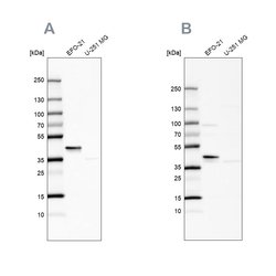 Invitrogen SERPINB1 Polyclonal Antibody 100 &mu;L; Unconjugated:Antibodies,