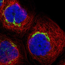 Invitrogen ACCS Polyclonal Antibody 100 &mu;L; Unconjugated:Antibodies,