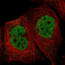 Invitrogen SF1 Polyclonal Antibody 100 &mu;L; Unconjugated:Antibodies,