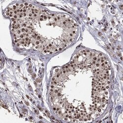 Invitrogen SF1 Polyclonal Antibody 100 &mu;L; Unconjugated:Antibodies,