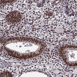 Invitrogen SF1 Polyclonal Antibody 100 &mu;L; Unconjugated:Antibodies,