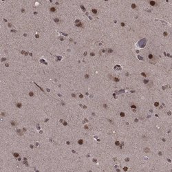 Invitrogen SF1 Polyclonal Antibody 100 &mu;L; Unconjugated:Antibodies,