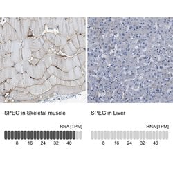 Invitrogen SPEG Polyclonal Antibody 100 &mu;L; Unconjugated:Antibodies,