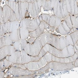 Invitrogen SPEG Polyclonal Antibody 100 &mu;L; Unconjugated:Antibodies,