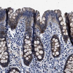 Invitrogen SPEG Polyclonal Antibody 100 &mu;L; Unconjugated:Antibodies,