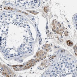 Invitrogen SPEG Polyclonal Antibody 100 &mu;L; Unconjugated:Antibodies,