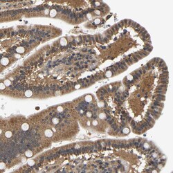Invitrogen ARHGEF12 Polyclonal Antibody 100 &mu;L; Unconjugated:Antibodies,
