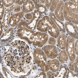 Invitrogen ARHGEF12 Polyclonal Antibody 100 &mu;L; Unconjugated:Antibodies,