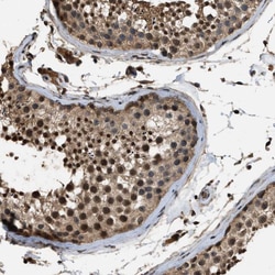 Invitrogen DENND6B Polyclonal Antibody 100 &mu;L; Unconjugated:Antibodies,