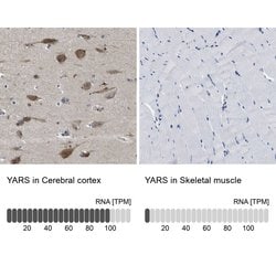 Invitrogen YARS Polyclonal Antibody 100 &mu;L; Unconjugated:Antibodies,