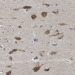 Invitrogen YARS Polyclonal Antibody 100 &mu;L; Unconjugated:Antibodies,