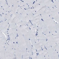 Invitrogen YARS Polyclonal Antibody 100 &mu;L; Unconjugated:Antibodies,