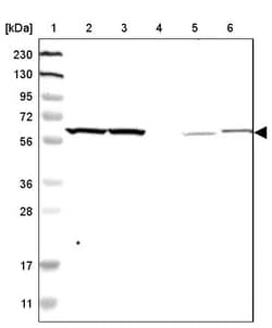 Invitrogen YARS Polyclonal Antibody 100 &mu;L; Unconjugated:Antibodies,