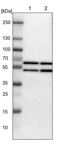 Invitrogen YARS Polyclonal Antibody 100 &mu;L; Unconjugated:Antibodies,