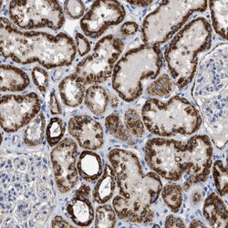 Invitrogen SLC25A13 Polyclonal Antibody 100 &mu;L; Unconjugated:Antibodies,