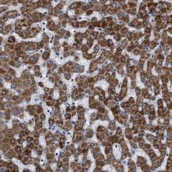 Invitrogen SLC25A13 Polyclonal Antibody 100 &mu;L; Unconjugated:Antibodies,