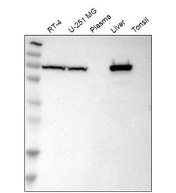 Invitrogen SLC25A13 Polyclonal Antibody 100 &mu;L; Unconjugated:Antibodies,