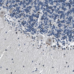 Invitrogen PHLDA1 Polyclonal Antibody 100 &mu;L; Unconjugated:Antibodies,