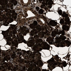 Invitrogen PHLDA1 Polyclonal Antibody 100 &mu;L; Unconjugated:Antibodies,