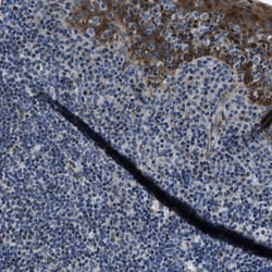 Invitrogen PHLDA1 Polyclonal Antibody 100 &mu;L; Unconjugated:Antibodies,
