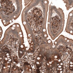 Invitrogen IL17RE Polyclonal Antibody 100 &mu;L; Unconjugated:Antibodies,