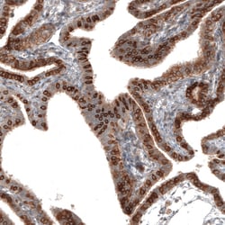 Invitrogen IL17RE Polyclonal Antibody 100 &mu;L; Unconjugated:Antibodies,
