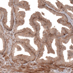 Invitrogen IL17RE Polyclonal Antibody 100 &mu;L; Unconjugated:Antibodies,
