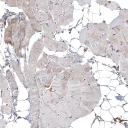 Invitrogen IL17RE Polyclonal Antibody 100 &mu;L; Unconjugated:Antibodies,
