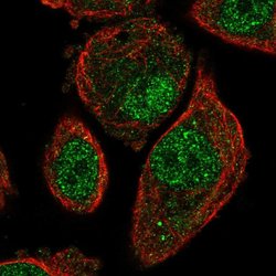 MCTP1 Polyclonal Antibody, Invitrogen 100 &mu;L; Unconjugated:Antibodies,
