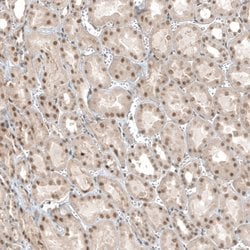 Invitrogen&trade;&nbsp;TET1 Polyclonal Antibody