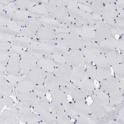 Invitrogen ABCB11 Polyclonal Antibody 100 &mu;L; Unconjugated:Antibodies,