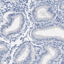 Invitrogen ABCB11 Polyclonal Antibody 100 &mu;L; Unconjugated:Antibodies,
