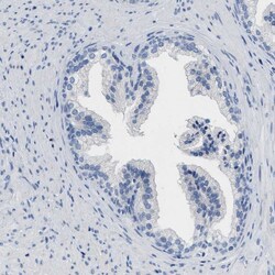 Invitrogen ABCB11 Polyclonal Antibody 100 &mu;L; Unconjugated:Antibodies,