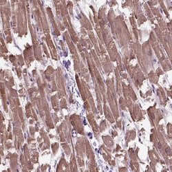 Invitrogen XK Polyclonal Antibody 100 &mu;L; Unconjugated:Anticuerpos