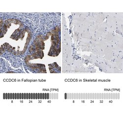 Invitrogen CCDC6 Polyclonal Antibody 100 &mu;L; Unconjugated:Antibodies,