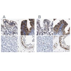 Invitrogen CCDC6 Polyclonal Antibody 100 &mu;L; Unconjugated:Antibodies,