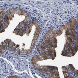 Invitrogen CCDC6 Polyclonal Antibody 100 &mu;L; Unconjugated:Antibodies,