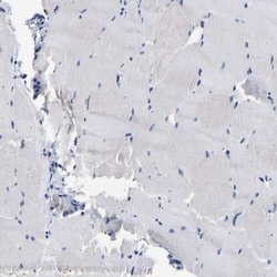 Invitrogen CCDC6 Polyclonal Antibody 100 &mu;L; Unconjugated:Antibodies,