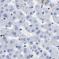 Invitrogen CCDC6 Polyclonal Antibody 100 &mu;L; Unconjugated:Antibodies,