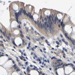 Invitrogen CCDC6 Polyclonal Antibody 100 &mu;L; Unconjugated:Antibodies,