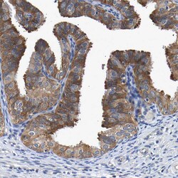 Invitrogen CCDC6 Polyclonal Antibody 100 &mu;L; Unconjugated:Antibodies,