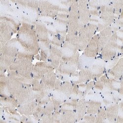 Invitrogen CCDC6 Polyclonal Antibody 100 &mu;L; Unconjugated:Antibodies,