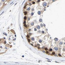 Invitrogen CCDC6 Polyclonal Antibody 100 &mu;L; Unconjugated:Antibodies,