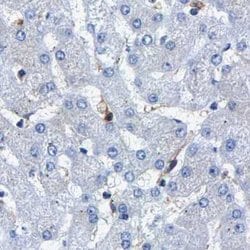 Invitrogen CCDC6 Polyclonal Antibody 100 &mu;L; Unconjugated:Antibodies,