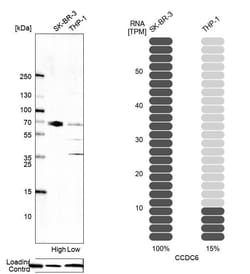 Invitrogen CCDC6 Polyclonal Antibody 100 &mu;L; Unconjugated:Antibodies,