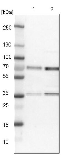 Invitrogen CCDC6 Polyclonal Antibody 100 &mu;L; Unconjugated:Antibodies,
