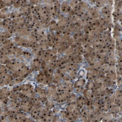 Invitrogen CROT Polyclonal Antibody 100 &mu;L; Unconjugated:Antibodies,