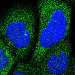 Invitrogen RAP1GDS1 Polyclonal Antibody 100 &mu;L; Unconjugated:Antibodies,